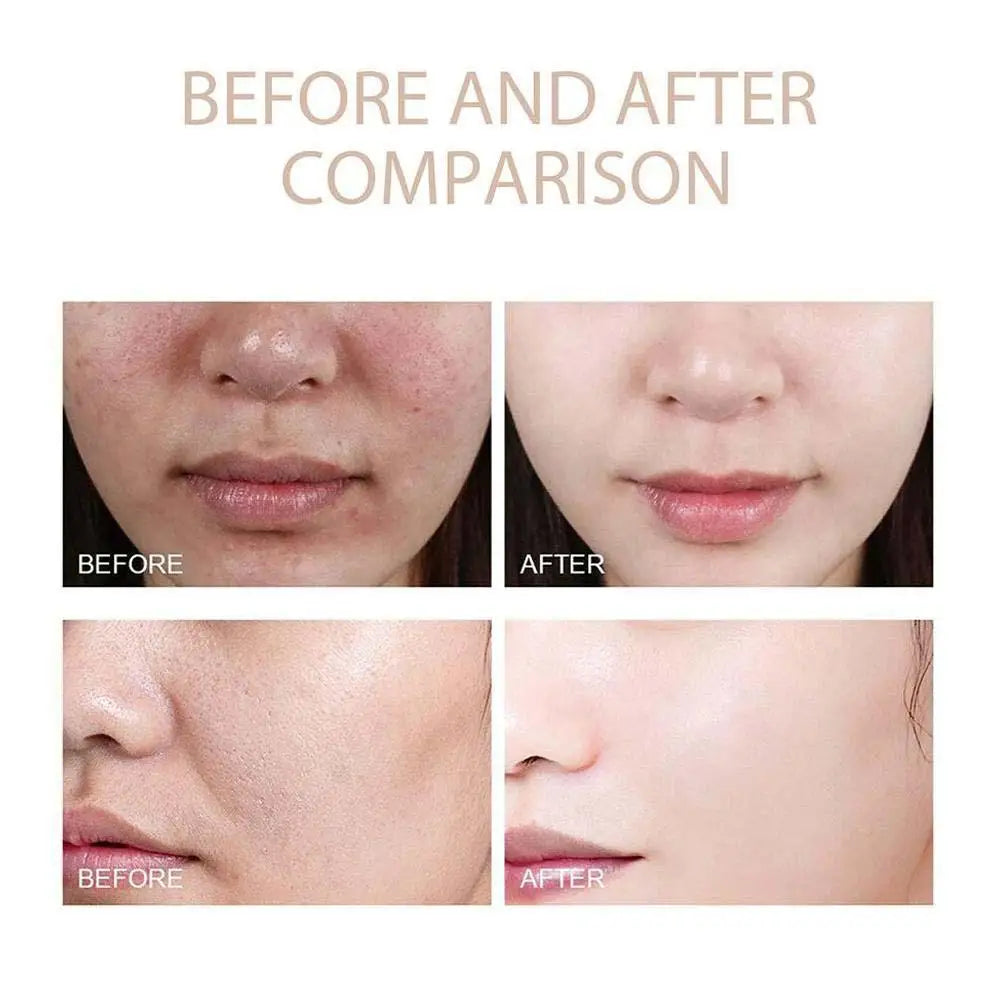 Korean Dr. Melaxin White And Black Rice Exfoliating Hydrating Essence Moisturizing Gentle Exfoliation Soften Serum Skin Care